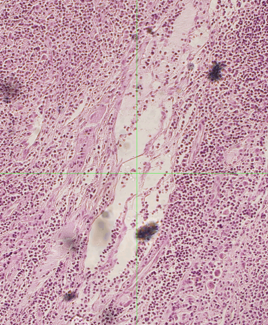 ../img/eng/stg_largeimagestagescanningwmacro_distortion_example_02.png image
