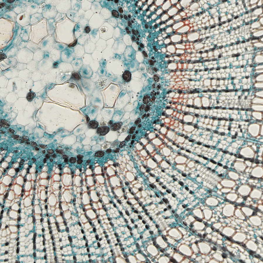 ../img/eng/stg_largeimagestagescanningwmacro_distortion_example_05.png image