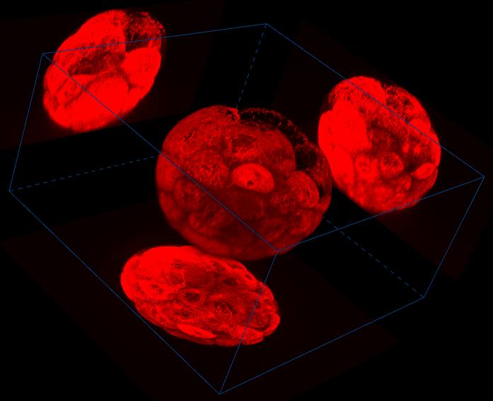 ../img/volumeview_image_maxip.png image
