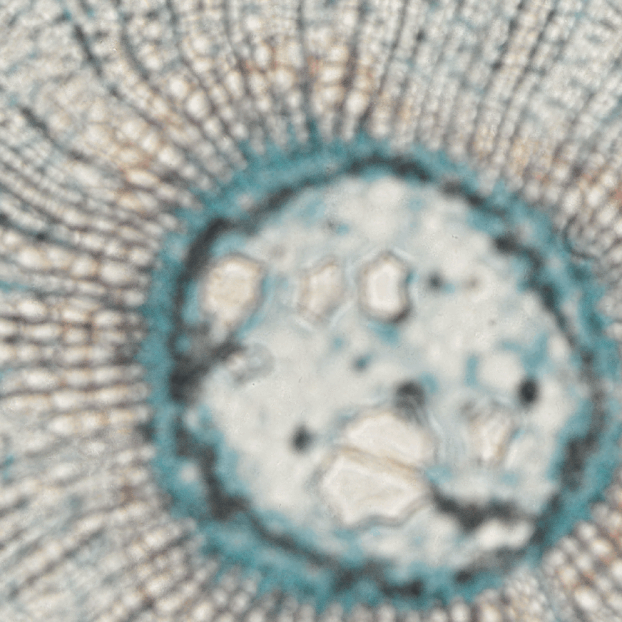 ../img/eng/stg_largeimagestagescanningwmacro_distortion_example_03.png image