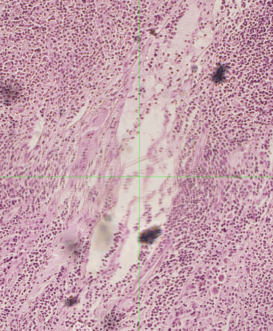 ../img/eng/stg_largeimagestagescanningwmacro_distortion_example_01.png image